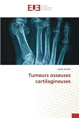 Tumeurs osseuses cartilagineuses 1