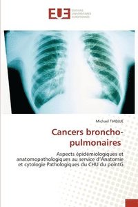 bokomslag Cancers broncho-pulmonaires