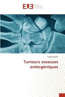 Tumeurs osseuses ostogniques 1