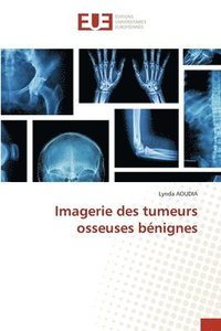 bokomslag Imagerie des tumeurs osseuses bnignes