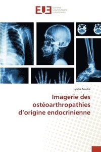bokomslag Imagerie des ostoarthropathies d'origine endocrinienne