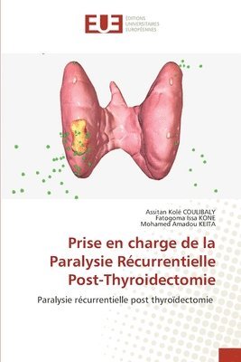 Prise en charge de la Paralysie Rcurrentielle Post-Thyroidectomie 1