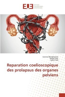 Reparation coelioscopique des prolapsus des organes pelviens 1