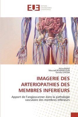 Imagerie Des Arteriopathies Des Membres Inferieurs 1