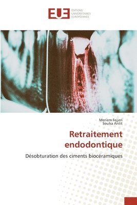 Retraitement endodontique 1