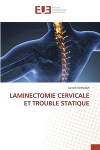 bokomslag Laminectomie Cervicale Et Trouble Statique