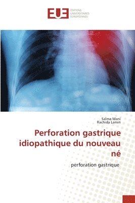 Perforation gastrique idiopathique du nouveau n 1