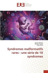 bokomslag Syndromes malformatifs rares: une série de 18 syndromes