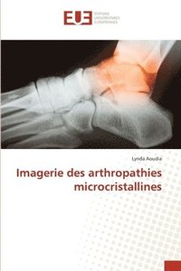 bokomslag Imagerie des arthropathies microcristallines