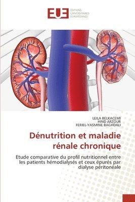 bokomslag Dnutrition et maladie rnale chronique