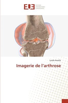 Imagerie de l'arthrose 1