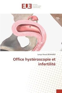 bokomslag Office hystroscopie et infertilit
