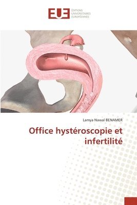 Office hystroscopie et infertilit 1