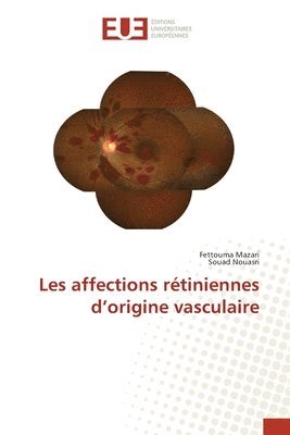 bokomslag Les affections rtiniennes d'origine vasculaire