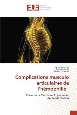 bokomslag Complications musculo articulaires de l'hmophilie