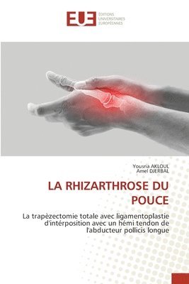 La Rhizarthrose Du Pouce 1