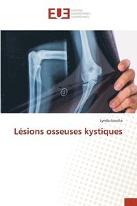 bokomslag Lsions osseuses kystiques