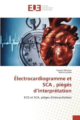 lectrocardiogramme et SCA, pigs d'interprtation 1