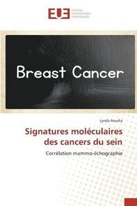 bokomslag Signatures molculaires des cancers du sein