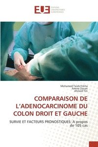 bokomslag Comparaison de l'Adenocarcinome Du Colon Droit Et Gauche