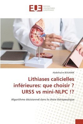 bokomslag Lithiases calicielles inférieures