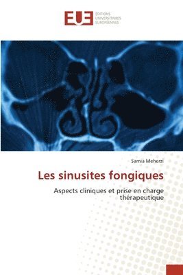 bokomslag Les sinusites fongiques