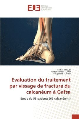 Farhat Chelbi, Abderrahmen Souid, Boujemaa Touati, Farhat CHELBI, Abderrahmen SOUID - Evaluation du traitement par vissage de fracture du calcanéum à Gafsa, Häftad