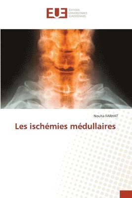 Les ischémies médullaires