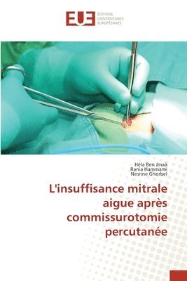 bokomslag L'insuffisance mitrale aigue aprs commissurotomie percutane