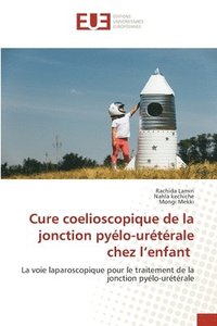 bokomslag Cure coelioscopique de la jonction pyélo-urétérale chez l'enfant