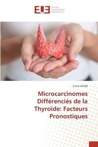 bokomslag Microcarcinomes Diffrencis de la Thyrode