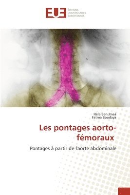 bokomslag Les pontages aorto-fémoraux