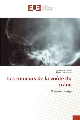 bokomslag Les tumeurs de la voûte du crâne