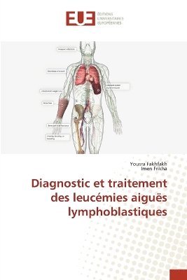 bokomslag Diagnostic et traitement des leucmies aigus lymphoblastiques