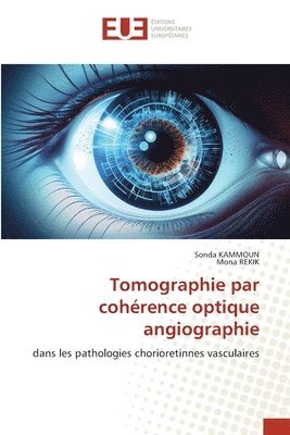 bokomslag Tomographie par cohrence optique angiographie