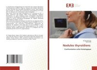 bokomslag Nodules thyrodiens