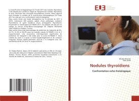 Nodules thyroïdiens