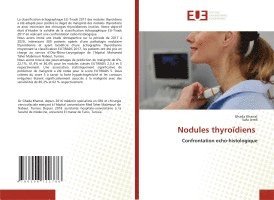 Nodules thyrodiens 1