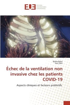 bokomslag chec de la ventilation non invasive chez les patients COVID-19