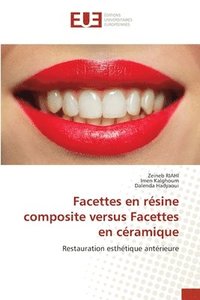 bokomslag Facettes en rsine composite versus Facettes en cramique