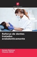 Sonam Baisoya, Vineeta Nikhil - Reforço de dentes tratados endodonticamente, Häftad