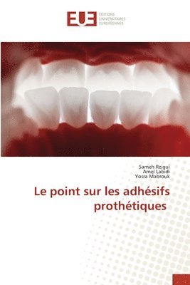 bokomslag Le point sur les adhsifs prothtiques