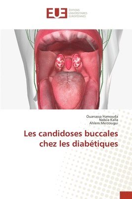 bokomslag Les candidoses buccales chez les diabétiques