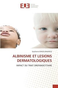 bokomslag Albinisme Et Lesions Dermatologiques