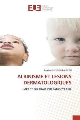 Albinisme Et Lesions Dermatologiques 1