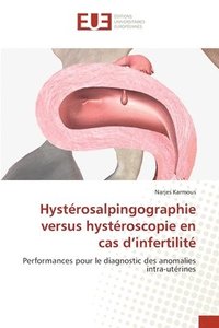 bokomslag Hystrosalpingographie versus hystroscopie en cas d'infertilit