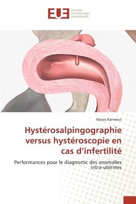 Hystrosalpingographie versus hystroscopie en cas d'infertilit 1