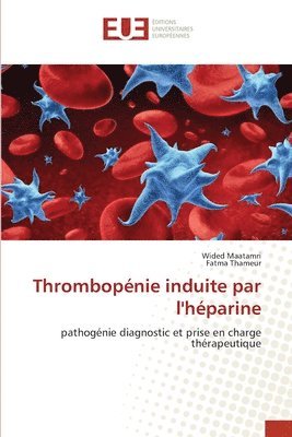 bokomslag Thrombopnie induite par l'hparine