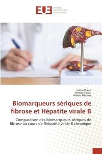 bokomslag Biomarqueurs sériques de fibrose et Hépatite virale B