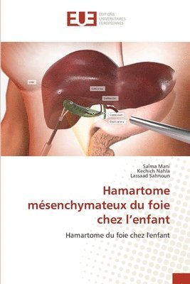 Hamartome msenchymateux du foie chez l'enfant 1